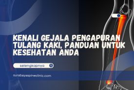 Kenali Gejala Pengapuran Tulang Kaki, Panduan untuk Kesehatan Anda